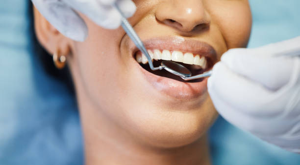 Best Knocked-Out Tooth (Avulsed Tooth) Treatment in Ranlo, NC